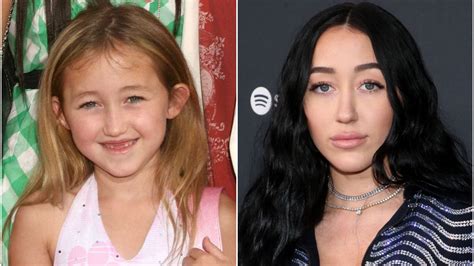 noah cyrus plastic surgery|The Stunning Transformation Of Noah Cyrus